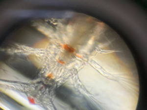 Plankton up close, this is an arthropod.